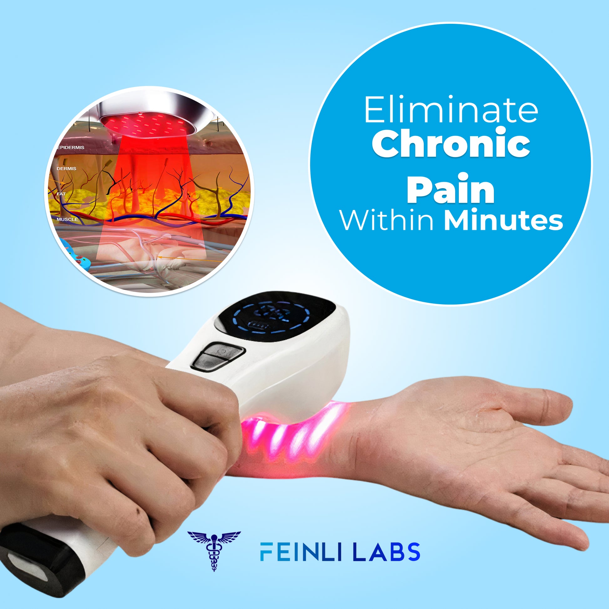 Feinli™ Cryo Laser System - Feinli